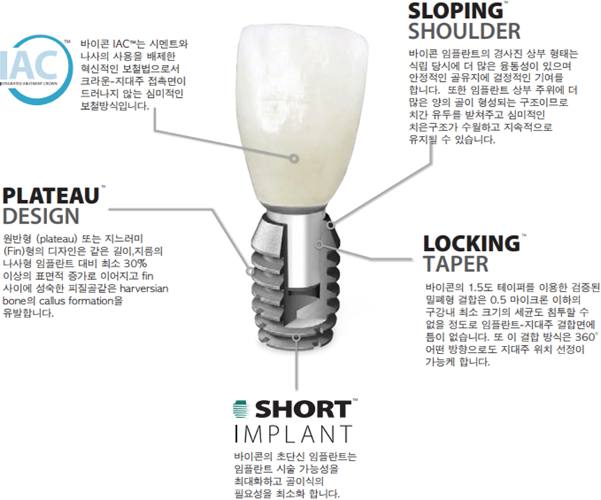 ���������ö�Ʈ